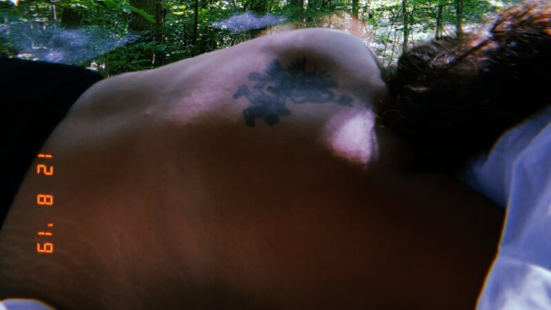 Learning to Accept My Stretch Marks: A Journey of Self-Love