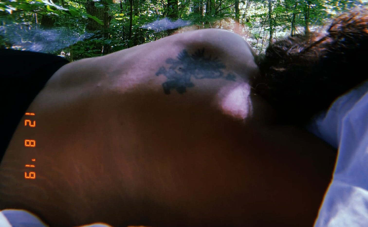 Learning to Accept My Stretch Marks: A Journey of Self-Love